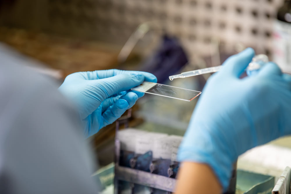 Close-up of gloved hands holding Pap smear slide, highlighting continued screening for high-risk or post-hysterectomy patients.