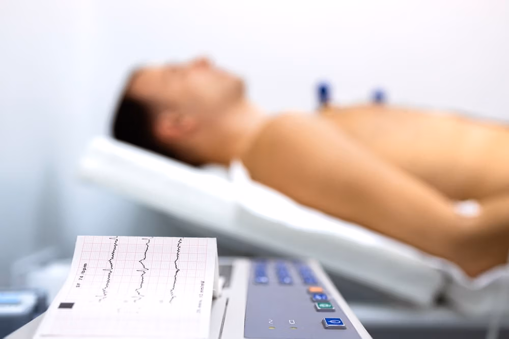 Close-up of EKG machine displaying heart rhythm chart with patient lying on exam table in background